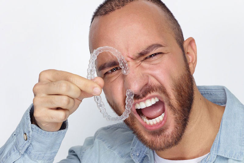 Aligner-Schienen Impression