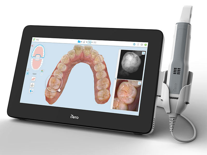 Vorteile von DentalMonitoring – weniger Termine, Echtzeit-Feedback, Kontrolle aus der Ferne