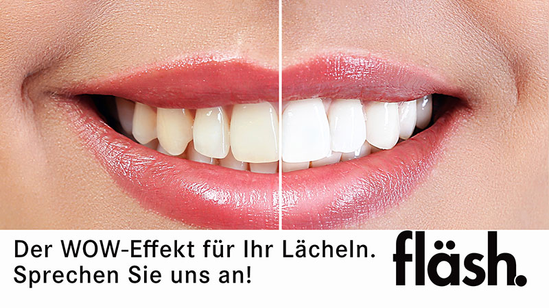 Strahlendes Lächeln dank professionellem Bleaching – jetzt in unserer Praxis verfügbar