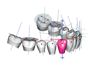 Digitale Kieferorthopädie