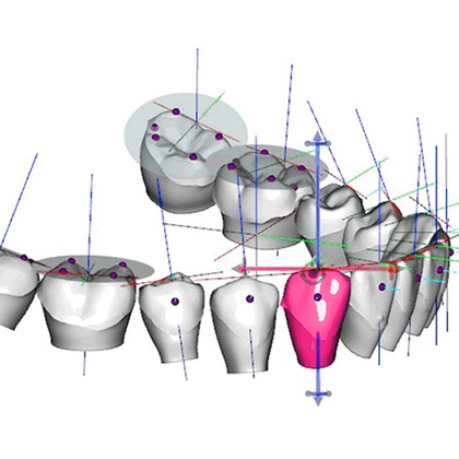 Digitale Kieferorthopädie