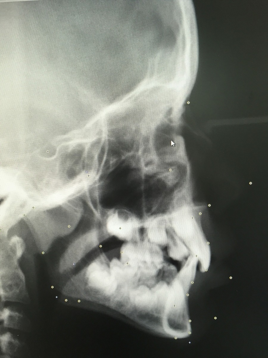 Digitale Kieferorthopädie – Detail