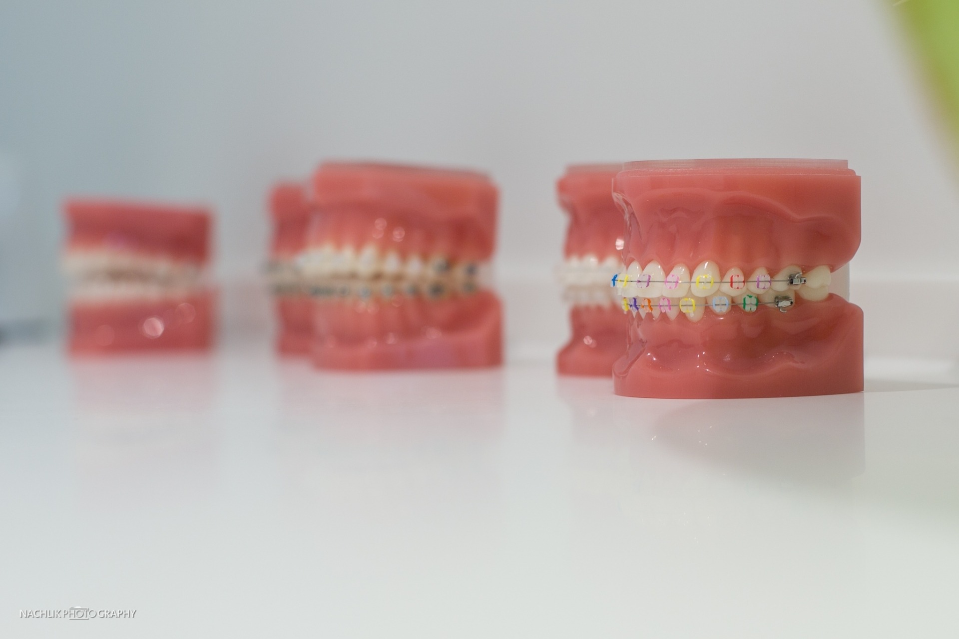 Keramikbrackets – Detail