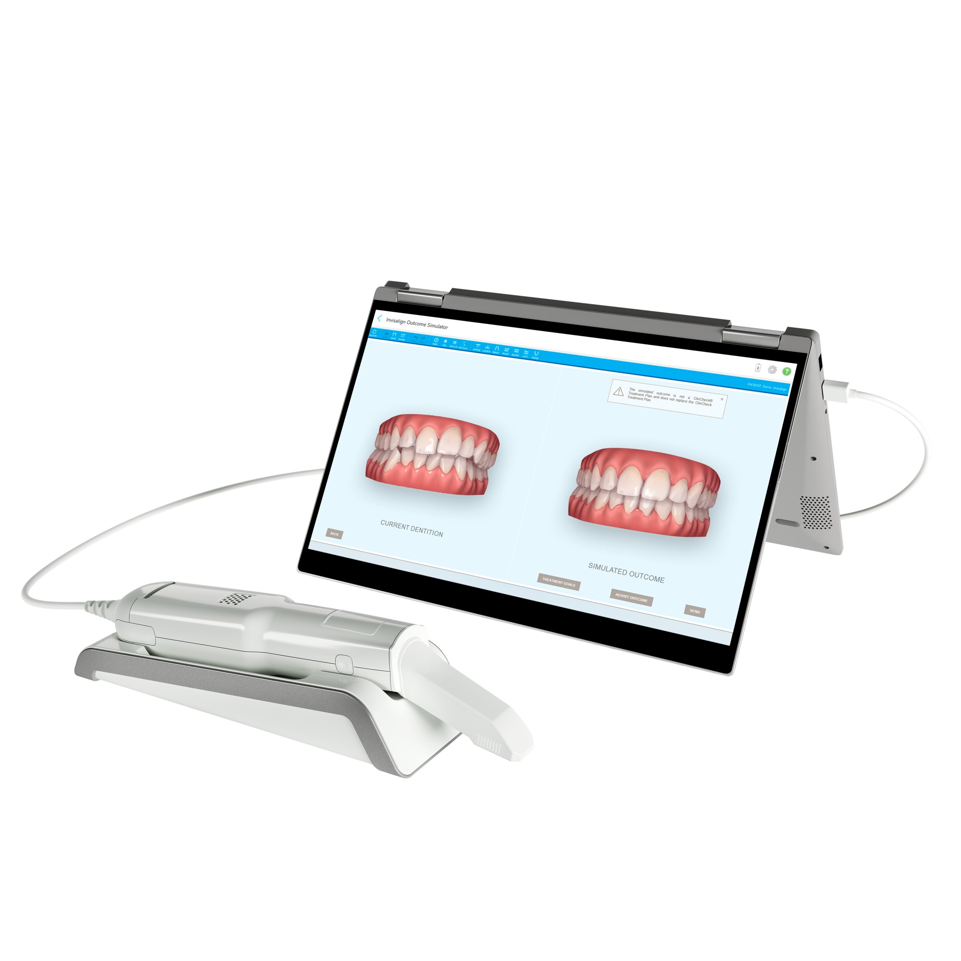 Scan statt Abdruck – Übersicht