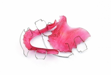 Herausnehmbare Zahnspangen